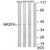 Rabbit Polyclonal Antibody to NR2F6