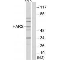 Rabbit Polyclonal Antibody to HARS