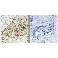 Rabbit Polyclonal Antibody to Lyl-1