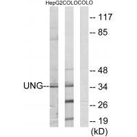 Rabbit Polyclonal Antibody to UNG