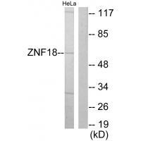 Rabbit Polyclonal Antibody to ZNF18