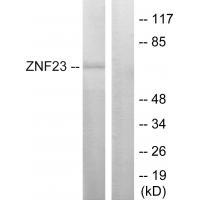 Rabbit Polyclonal Antibody to ZNF23