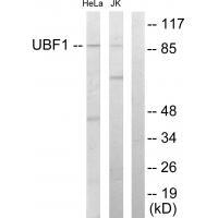 Rabbit Polyclonal Antibody to UBF1