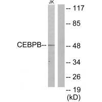 Rabbit Polyclonal Antibody to CEBPB