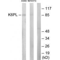 Rabbit Polyclonal Antibody to K6PL
