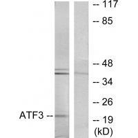 Rabbit Polyclonal Antibody to ATF3