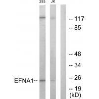 Rabbit Polyclonal Antibody to EFNA1