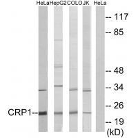 Rabbit Polyclonal Antibody to CRP1