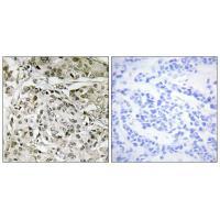 Rabbit Polyclonal Antibody to TAF1
