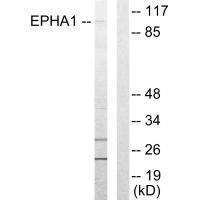 Rabbit Polyclonal Antibody to EPHA1