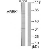 Rabbit Polyclonal Antibody to ARBK1