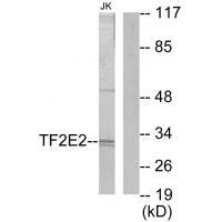 Rabbit Polyclonal Antibody to TF2E2