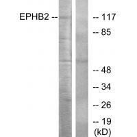 Rabbit Polyclonal Antibody to EPHB2
