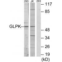 Rabbit Polyclonal Antibody to GLPK