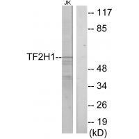 Rabbit Polyclonal Antibody to TF2H1