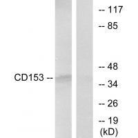Rabbit Polyclonal Antibody to CD153