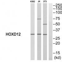 Rabbit Polyclonal Antibody to HOXD12