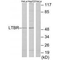 Rabbit Polyclonal Antibody to LTBR