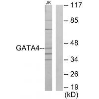 Rabbit Polyclonal Antibody to GATA4