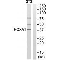 Rabbit Polyclonal Antibody to HOXA1