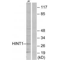 Rabbit Polyclonal Antibody to HINT1