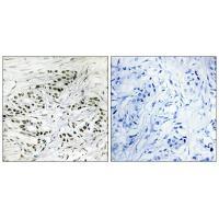 Rabbit Polyclonal Antibody to ERF