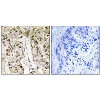Rabbit Polyclonal Antibody to HCFC1