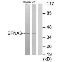 Rabbit Polyclonal Antibody to EFNA3