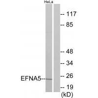 Rabbit Polyclonal Antibody to EFNA5