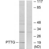 Rabbit Polyclonal Antibody to PTTG