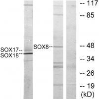 Rabbit Polyclonal Antibody to SOX8/9/17/18