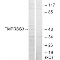 Rabbit Polyclonal Antibody to TMPRSS3