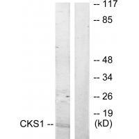 Rabbit Polyclonal Antibody to CKS1