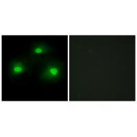 Rabbit Polyclonal Antibody to IPKA