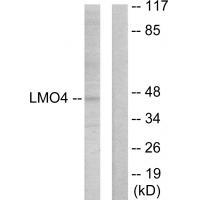 Rabbit Polyclonal Antibody to LMO4