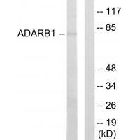 Rabbit Polyclonal Antibody to ADARB1