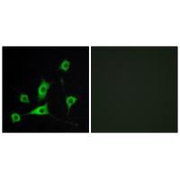 Rabbit Polyclonal Antibody to CRBP III