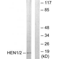 Rabbit Polyclonal Antibody to HEN1/2
