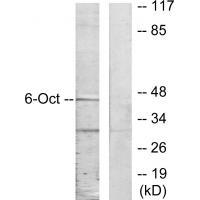 Rabbit Polyclonal Antibody to 45205