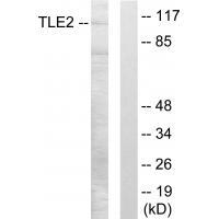 Rabbit Polyclonal Antibody to TLE2