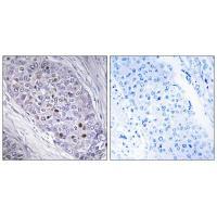 Rabbit Polyclonal Antibody to MEF2C