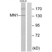 Rabbit Polyclonal Antibody to MN1