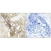 Rabbit Polyclonal Antibody to MED21