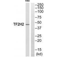 Rabbit Polyclonal Antibody to TF2H2