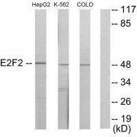 Rabbit Polyclonal Antibody to E2F2