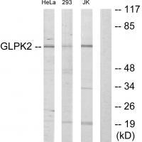 Rabbit Polyclonal Antibody to GLPK2