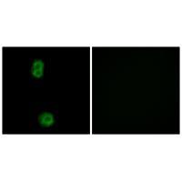 Rabbit Polyclonal Antibody to K010