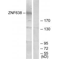 Rabbit Polyclonal Antibody to ZNF638