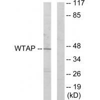 Rabbit Polyclonal Antibody to WTAP