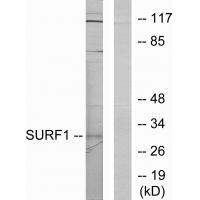 Rabbit Polyclonal Antibody to SURF1